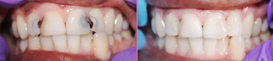 Dental Floss: Has It Really Been A Big Fat Lie? - Claire Hughes Dental