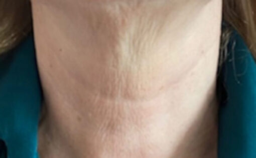 After - Claire Hughes Dental