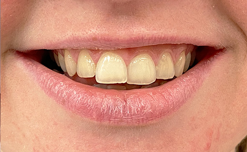 Before - Claire Hughes Dental