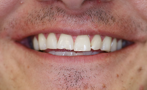 Before - Claire Hughes Dental