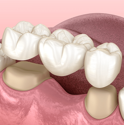 Treatment -Claire Hughes