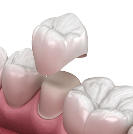 Treatment -Claire Hughes