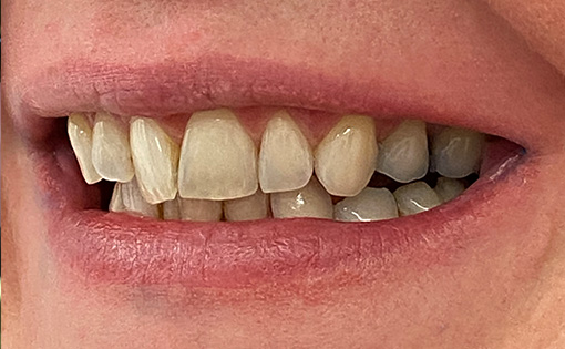 Before - Claire Hughes Dental
