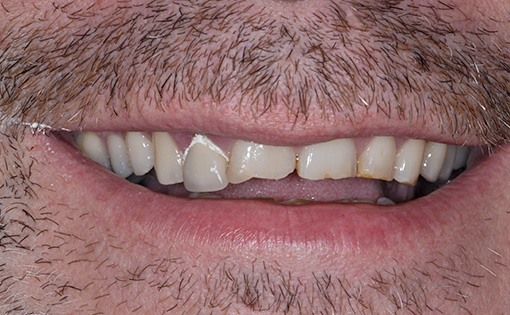 Before - Claire Hughes Dental