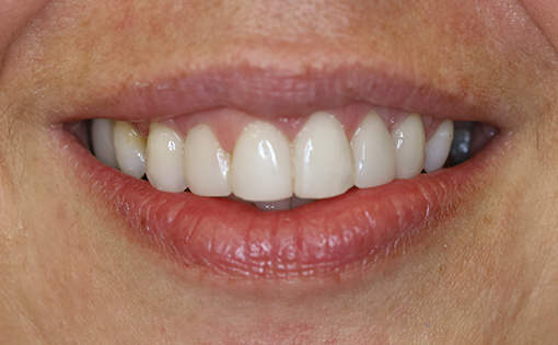 After - Claire Hughes Dental
