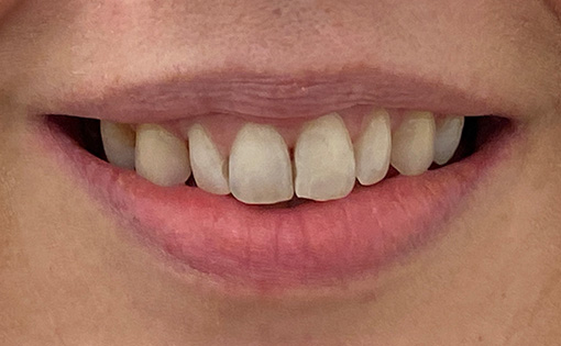 Before - Claire Hughes Dental