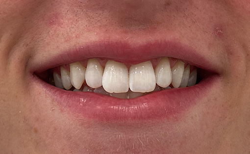 After - Claire Hughes Dental