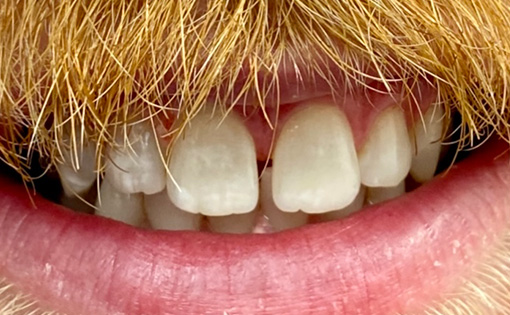 After - Claire Hughes Dental