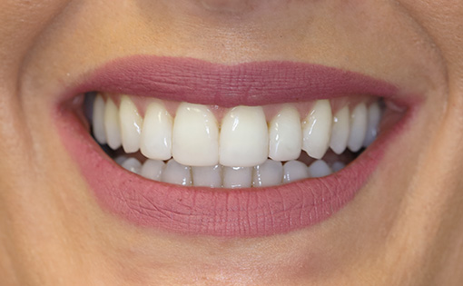 After - Claire Hughes Dental